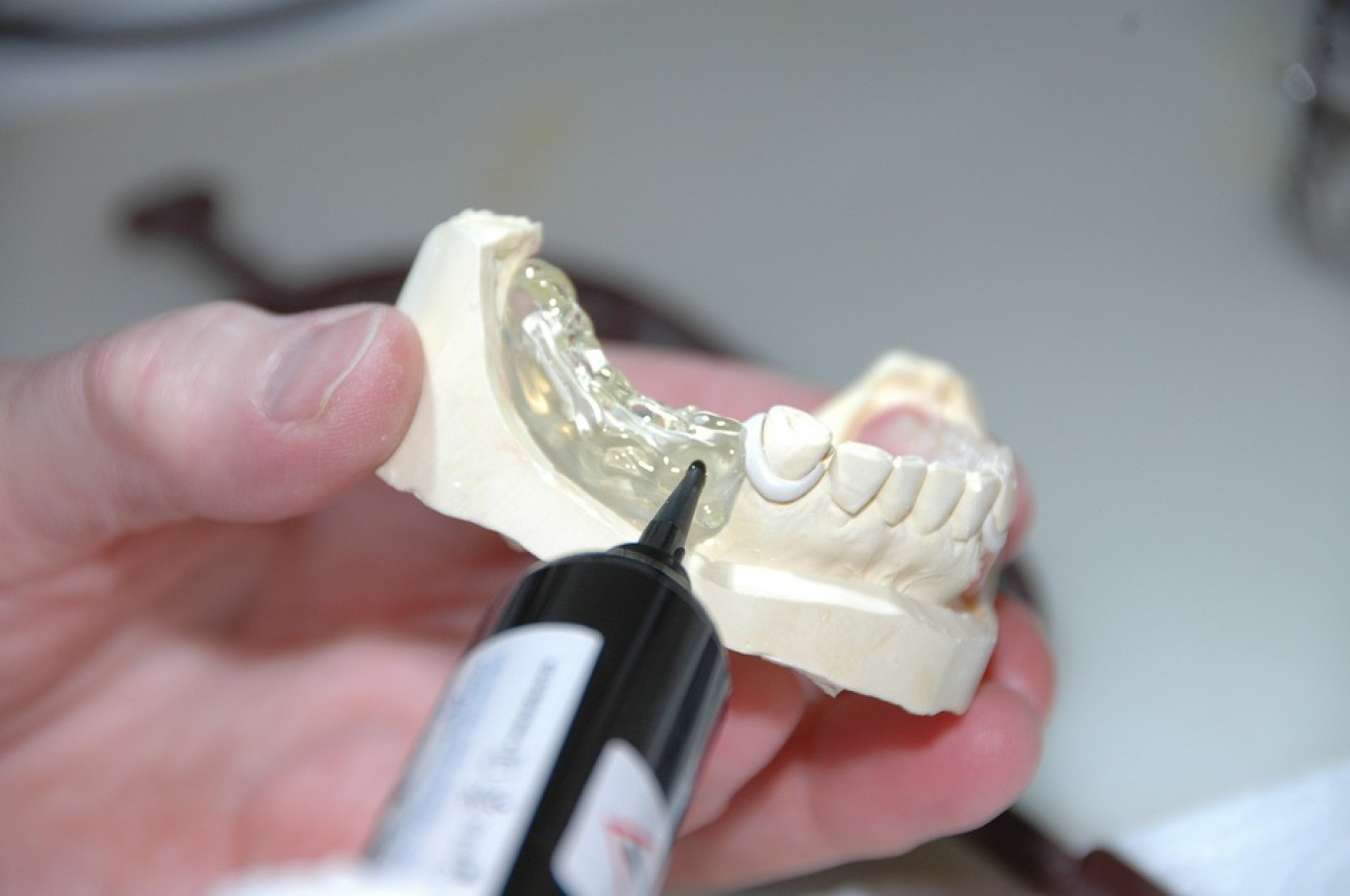 La filière de la prothèse dentaire cherche des profils de plus en plus tournés vers les nouvelles technologies.